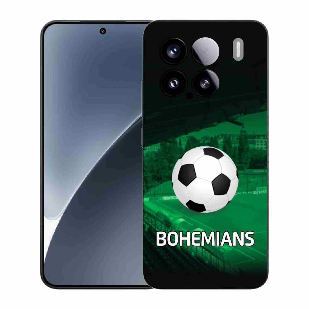 Gél borító mmCase a Xiaomi 15-öshöz - bohémek 1