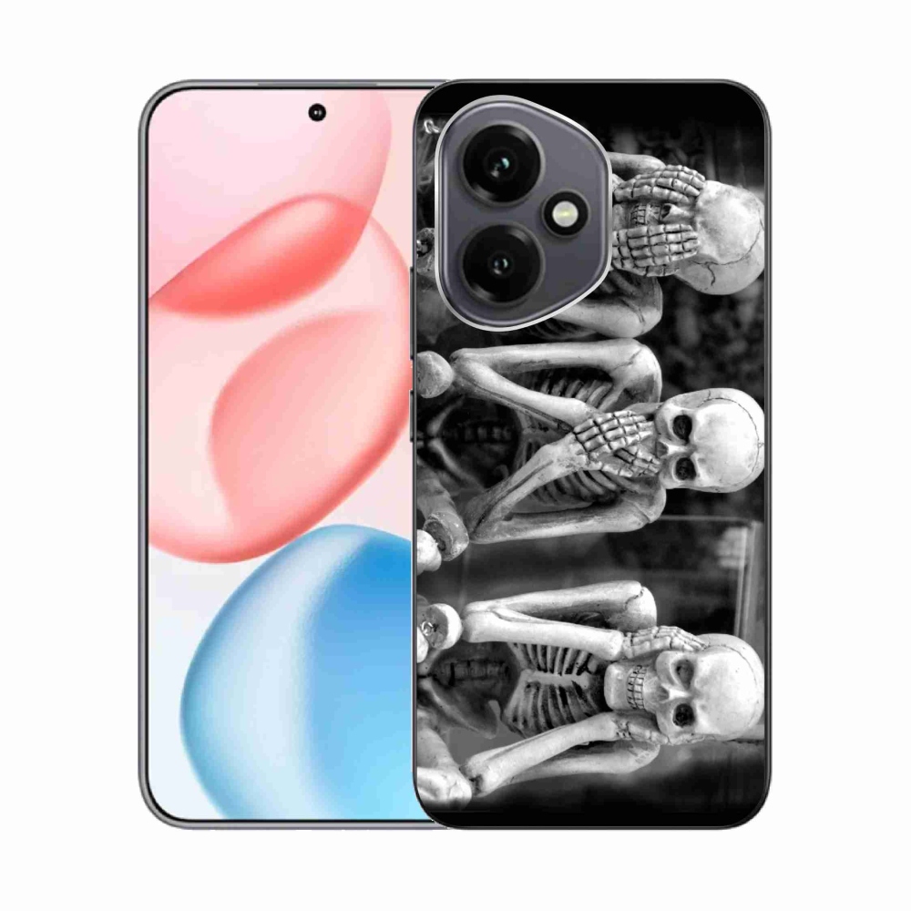 Zselés borítás mmCase a Honor 400-hoz - csontvázakhoz