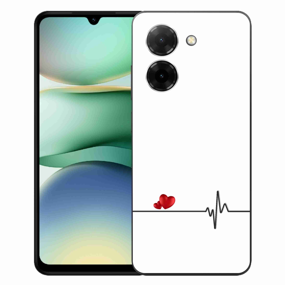 Gél borító mmCase a Xiaomi Redmi A5 (173.45x79.35x8.45mm) - szív és szívverés fehér háttérrel