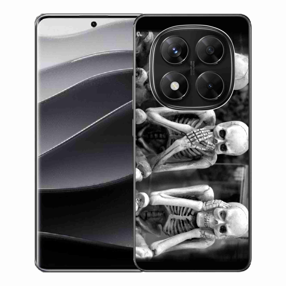 Gél borítás mmCase a Xiaomi Redmi Note 14 Pro 5G/Poco X7 5G - csontvázakhoz